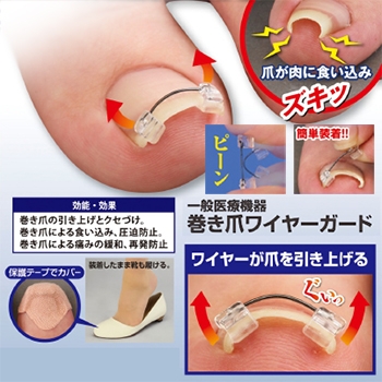 一般医療機器　巻き爪ワイヤーガード