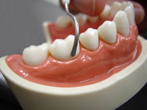 h675　歯石屋くん　ピック&ピック