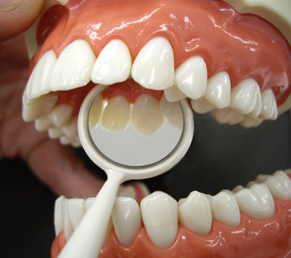 h676　歯石屋くん　ピック&ミラー